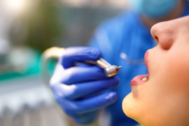 Best Wisdom Tooth Removal  in Platte, SD